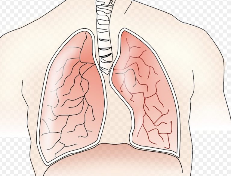 Cancer du poumon un nouveau traitement associant immunothérapies et